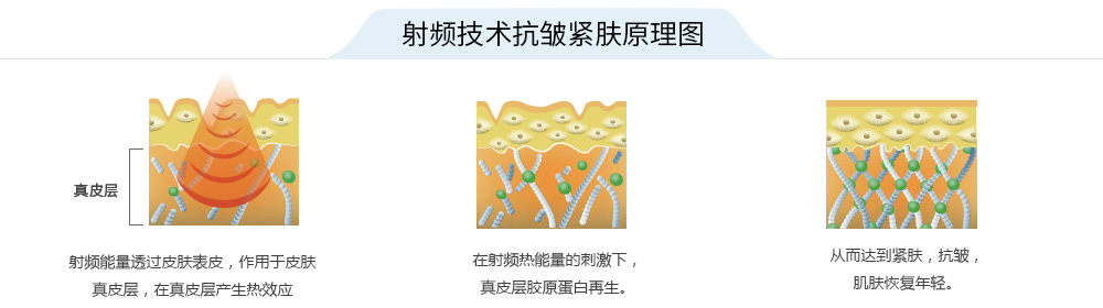 射頻美容儀